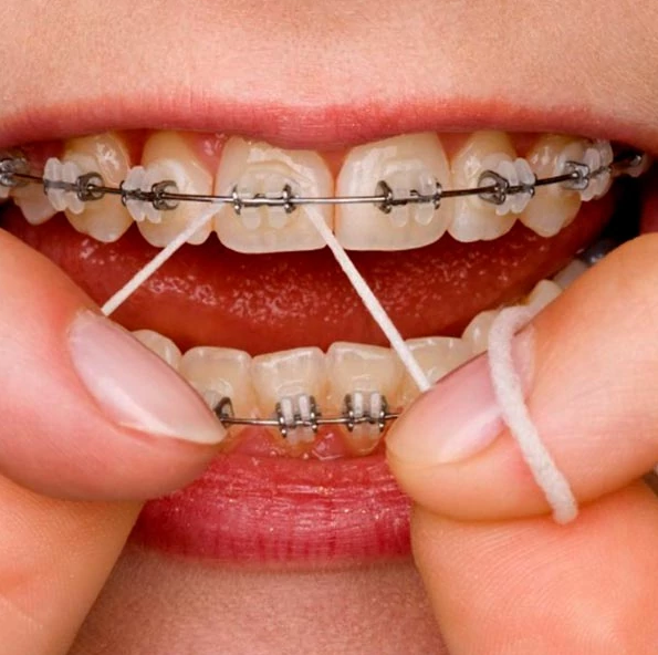 Зубна нитка Oral-B Super Floss 2в1, 50 шт 8700216538961 фото